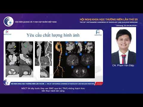 4. MSCT 64 dãy trước thay van ĐMC qua da (TAVI) những thách thức trên thực hành (CN. Phạm Văn Điệp)