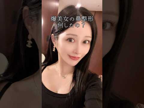 \爆美女の鼻整形なにしたの?/