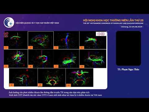 3. Ảnh hưởng của phơi nhiễm dioxin lên đường dẫn truyền TK trong não (TS. Phạm Ngọc Thảo)