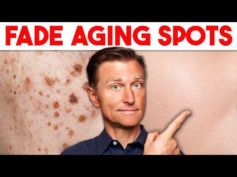 Age Spots Are NOT Normal Aging
