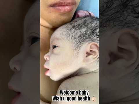 Welcome baby Wish u good health #shorts