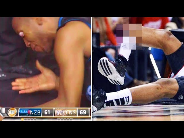 The Worst NBA Injuries of All Time
