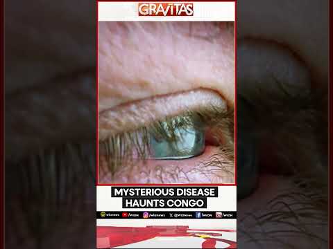 'Bleeding Eye Virus' On The Prowl In Rwanda | GRAVITAS | WION