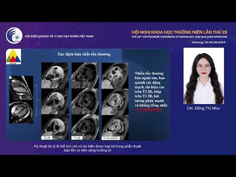 5. Kỹ thuật chụp CHT các tổn thương có kích thước nhỏ ở tim (CN. Phan Minh Thuận)