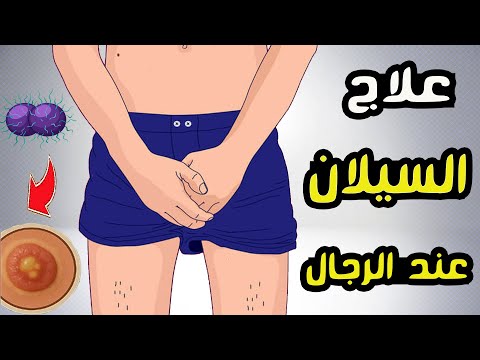 علاج مرض السيلان عند الرجال