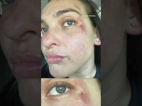 Woman loses pants on treadmill