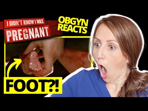 ObGyn Reacts: Didn't Know I Was Pregnant on a ROAD TRIP!?
