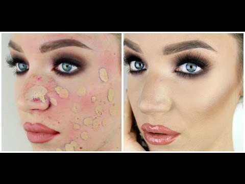 Foundation Routine to hide blotchy, pink skin! | Stephanie Lange - UCZQ0XPE7wxMafUf8dIHOxgQ