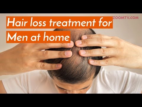 WATCH #Health | HAIR LOSS Treatment for MEN at Home | Grooming #Tips #Remedy