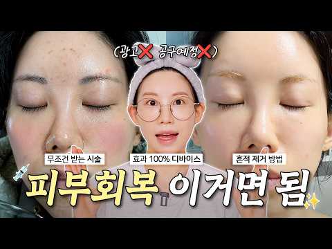 (노광고) 피부관리법 A-Z까지! 총정리💯 (피부과 시술, 최최종 뷰티디바이스, 흔적케어 100% 기초템, 건성피부 숨은 꿀템 )
