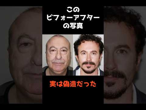 30歳若返りをうたうクリニックの偽造写真に迫る解説 サムネイル