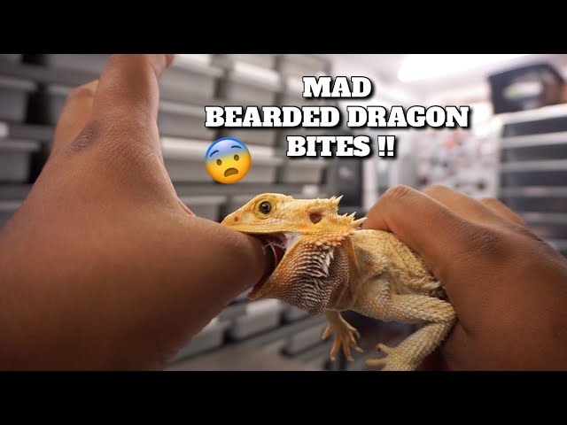 What To Do If A Bearded Dragon Bites You?