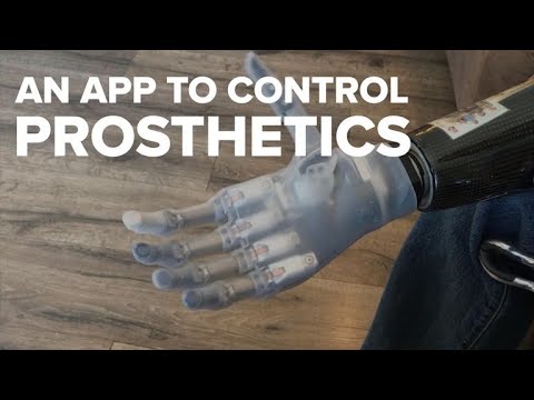 An app could help amputees better control their prosthetics - UCOmcA3f_RrH6b9NmcNa4tdg