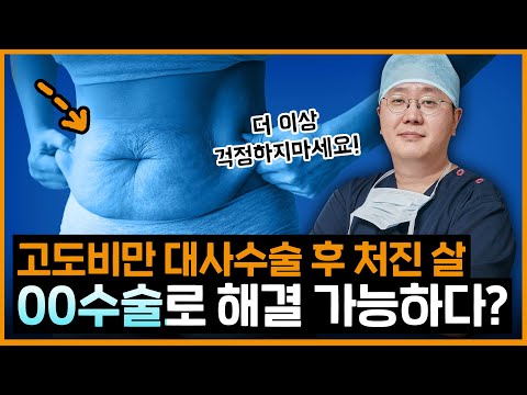 고도비만 대사수술 후 처진살 해결법..