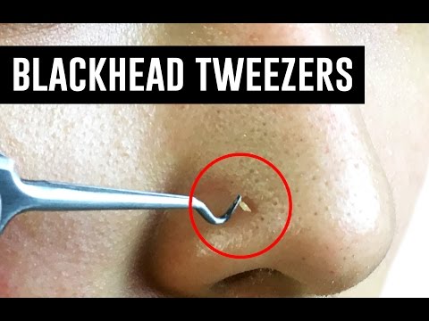 Tweezers That Remove Blackheads! TINA TRIES IT - UC0ng0jJflTuJBBH5DGvr1Pw