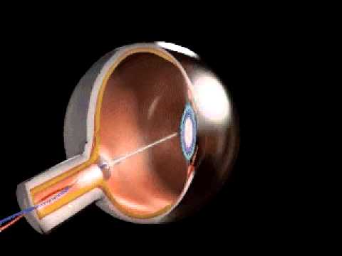 Ojo, su composición (Bodyworks 5.0)