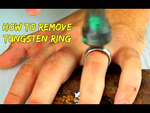 Emergency Removal of a Tungsten Ring - UCe_vXdMrHHseZ_esYUskSBw