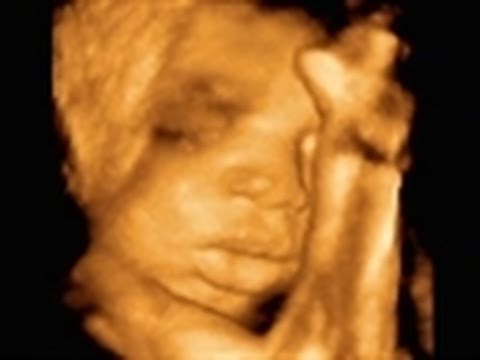 Does Music Affect A Fetus? - UCqOoboPm3uhY_YXhvhmL-WA