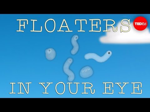 What are those floaty things in your eye? - Michael Mauser - UCsooa4yRKGN_zEE8iknghZA