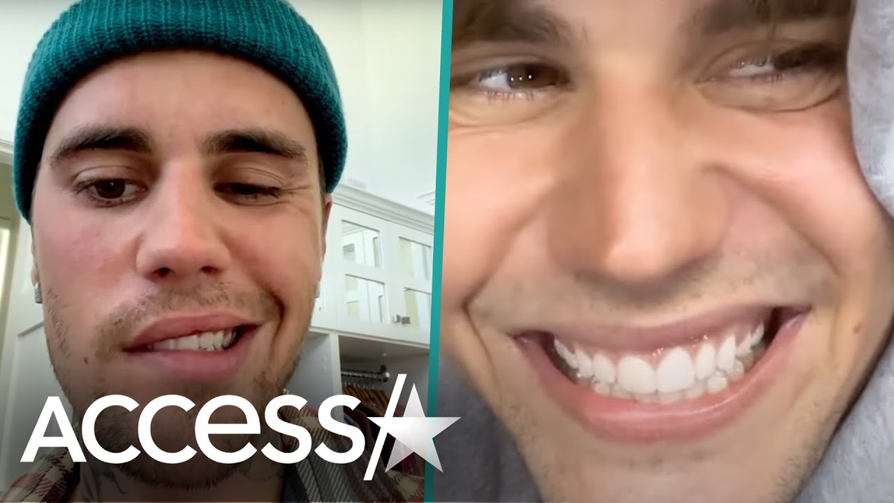 Justin Bieber Shares Facial Mobility Update After Suffering Partial Facial Paralysis