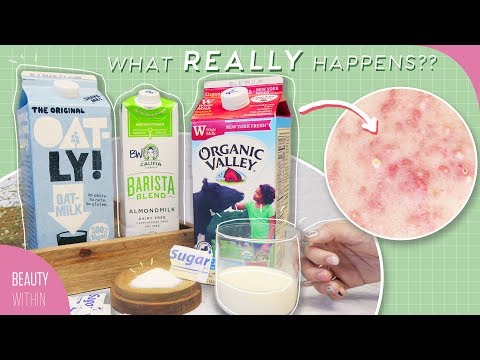 Skincare Mistakes That Cause Acne, Breakouts & Inflammation: Sugar & Dairy - UC8f2CDyLibpGYSN3O2LfDwg