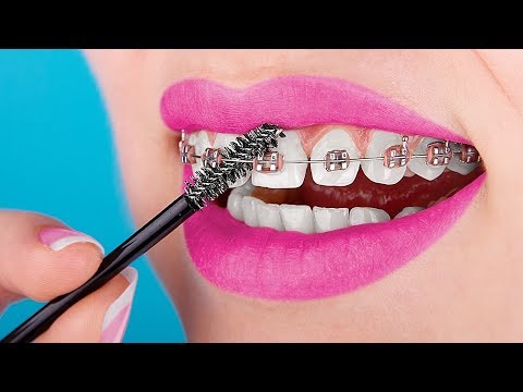 15 Crazy Braces Life Hacks You Need To Know About - UCWwqHwqLSrdWMgp5DZG5Dzg