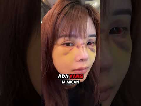 TERNYATA NORMAL😭sempet panik