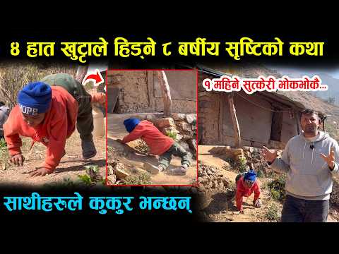 ४ हात खुट्टाले टेकेर हिँड्ने ८ वर्षीय सृष्टिको कथा,अरुले कुकुर भन्छन । Baglung News