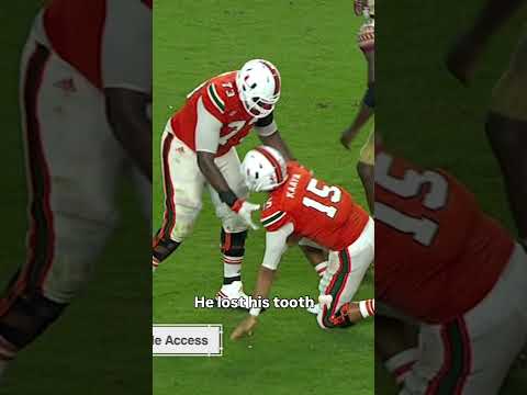 The tooth was recovered 😅 #miamihurricanes #accfootball #collegefootball