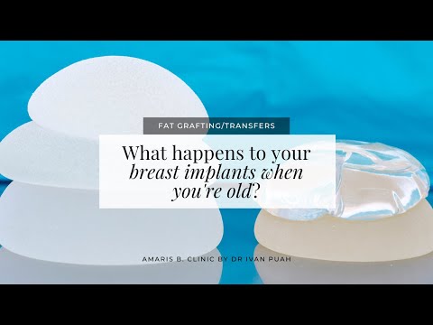 What happens to your breast implants when you're old? | Amaris B. Clinic by Dr Ivan Puah