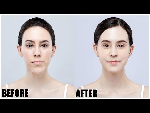 I Got Plastic Surgery in Korea || Before & After || Double Jaw Surgery Experience Part 2