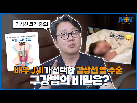 배우 J씨가 선택한 갑상선 암 수술법, 구강..