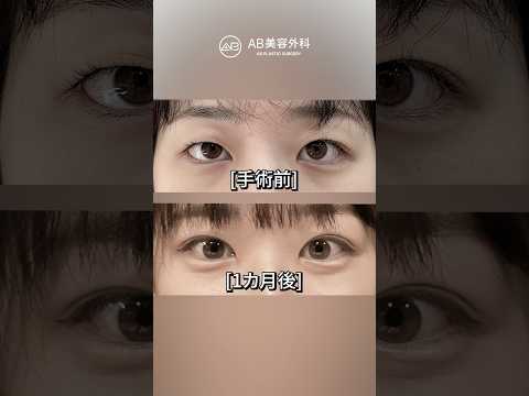 二重幅ごとの違いをチェック #shorts