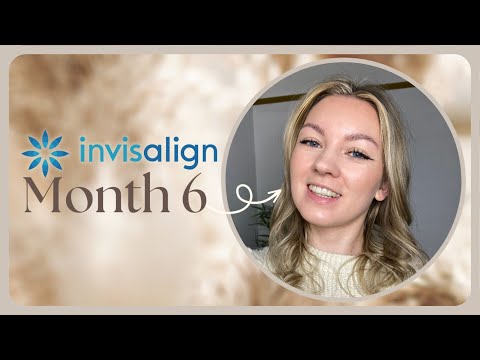 Invisalign 6 Month Review | AD PR 🦷