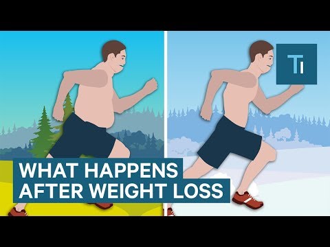 What Losing Weight Does To Your Body And Brain - UCVLZmDKeT-mV4H3ToYXIFYg