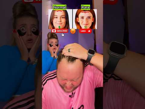 NORMAL OR RARE😈🔥 Your forehead 🤯