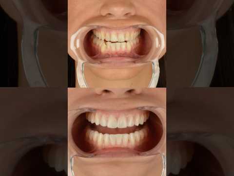 Clinica Dental DEN Barcelona