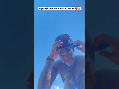 Beyond the bruises is still showing on YouTube ❤️‼️ #fypシ #blowup #davido #blowup #davido