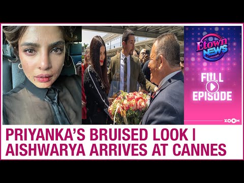 Priyanka Chopra’s BRUISED face | Aishwarya Rai’s WELCOME at Cannes Film Festival | E-Town News