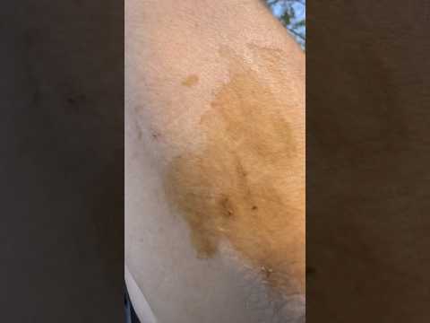 Plooped In Horse Poop 💩#countrydiggers #horse #poop