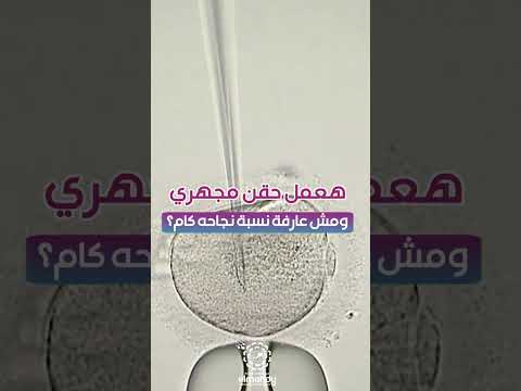 #حقن_مجهري #تأخر_حمل #اطفال_انابيب