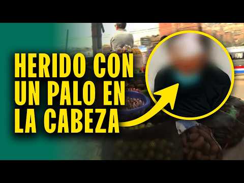 Golpean brutalmente a adulto mayor: Comerciante queda gravemente herido tras negarse a pagar cupos