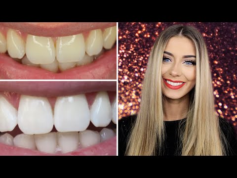 How I Whitened My Teeth at Home | Danielle Mansutti - UCJRFJl5UDs4Citzs-uRcrxQ