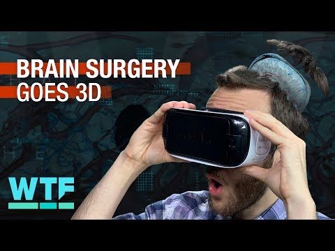 Brain surgery goes 3D | What the Future - UCOmcA3f_RrH6b9NmcNa4tdg