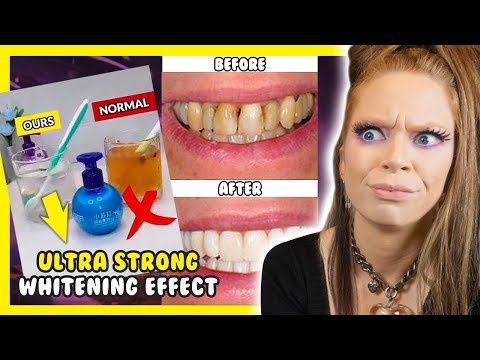 The TRUTH about 'INSTANT Whitening TOOTHPASTE' - UCGwPbAQdGA3_88WBuGtg9tw