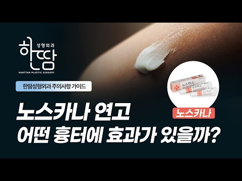 “노스카나 연고. 어떤 흉..