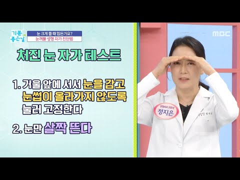 [기분 좋은 날] 눈 <strong>크게</strong> 뜰 때 힘든가요? 눈꺼풀 성형 자가 진단법, MBC 260831 방송