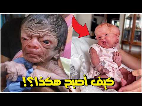 أطفال غير عاديين حيّروا الأطباء… قصص حقيقية ستدهشك 😱 | لن تصدق ما وُلدوا به