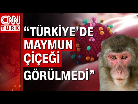 Türkiye'de maymun çiçeği vakası görüldü mü? Sağlık Bakanlığı'ndan açıklama!