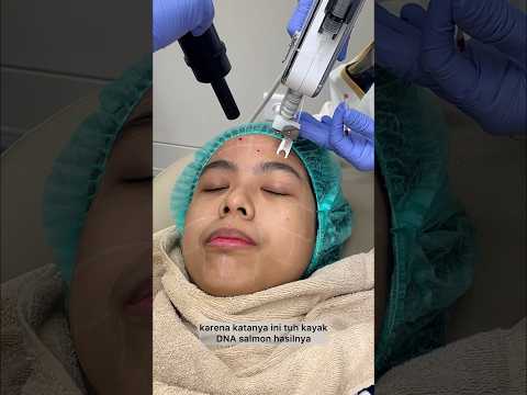Treatment di klinik se-instan itu hasilnya? Pengalaman suntik Insta Glow Meso Injection di ZAP